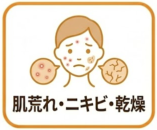 肌荒れ・ニキビ・乾燥